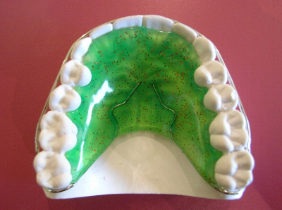 removable plate